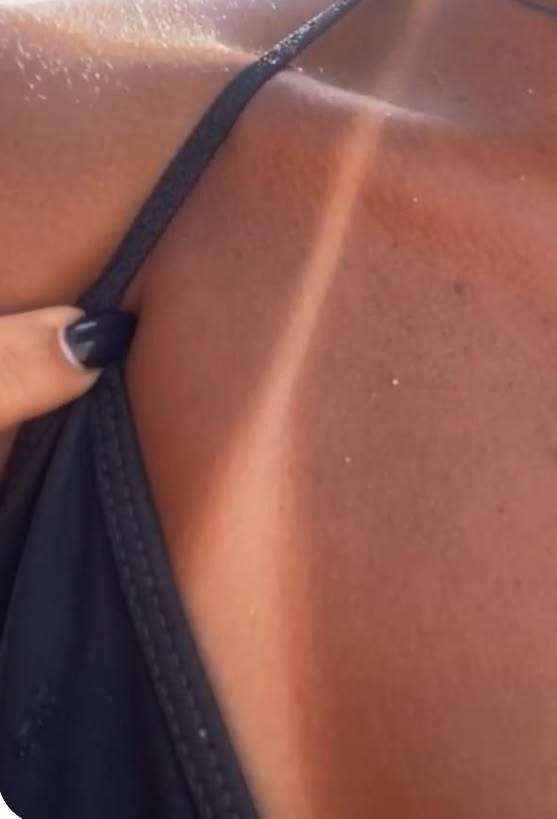 Antes e depois HUE 01