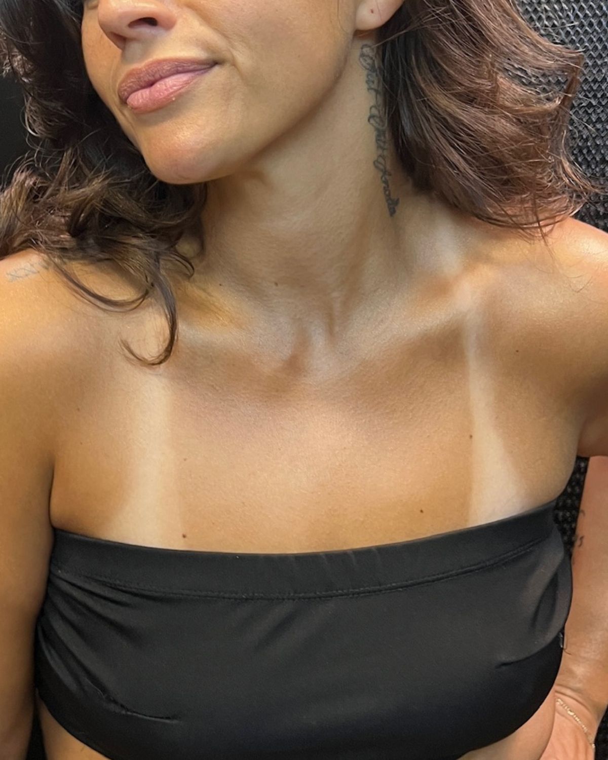 Antes e depois HUE 02